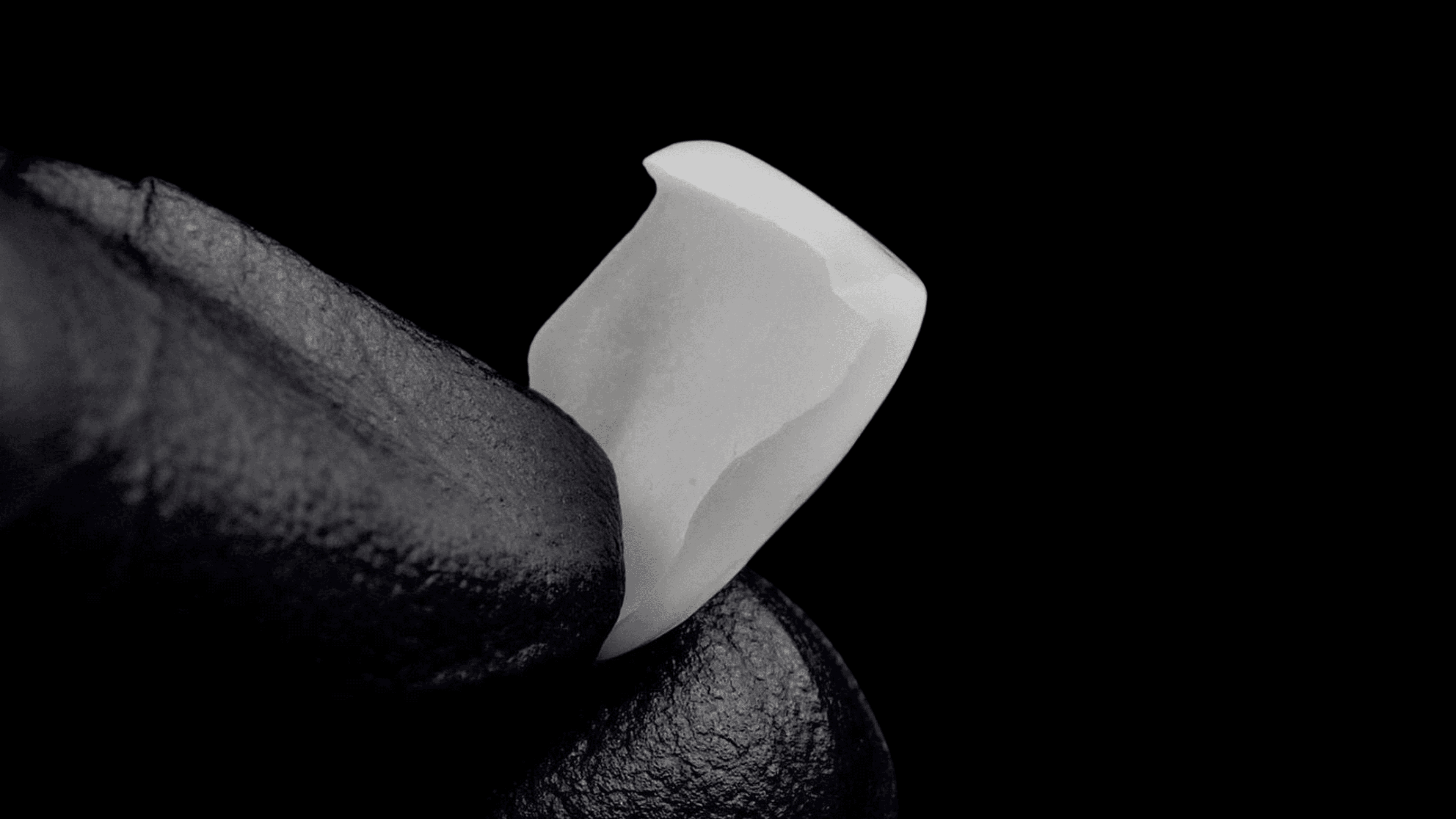 Ultra-thin porcelain veneer showing craftsmanship detail