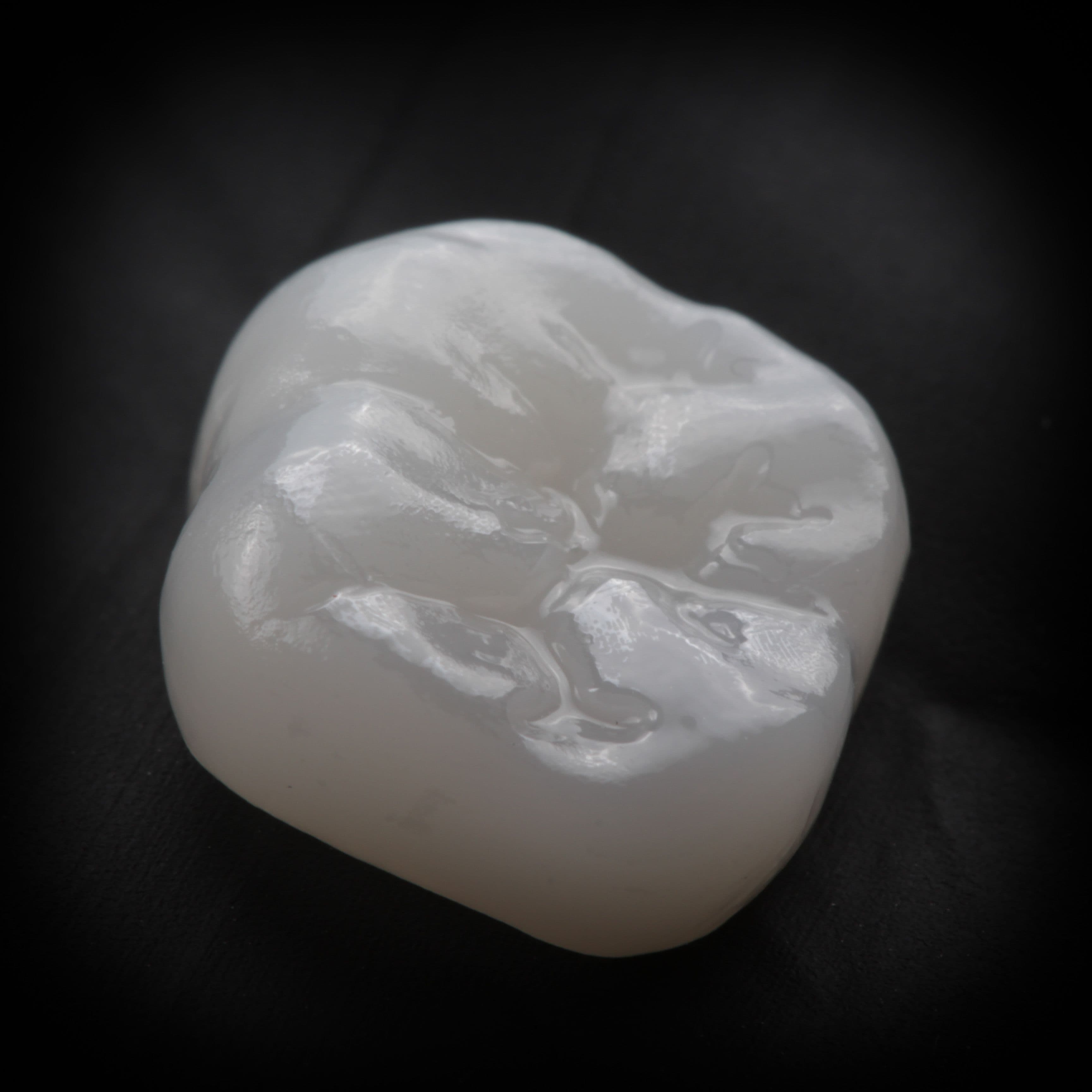 Custom porcelain dental crown close-up