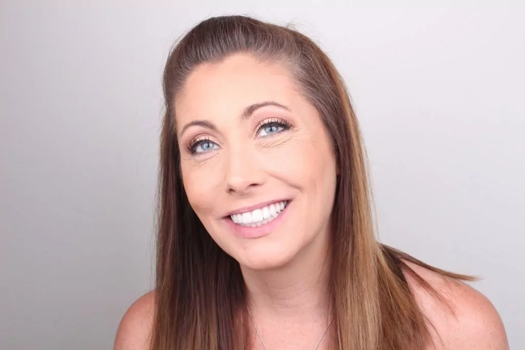 smile makeover