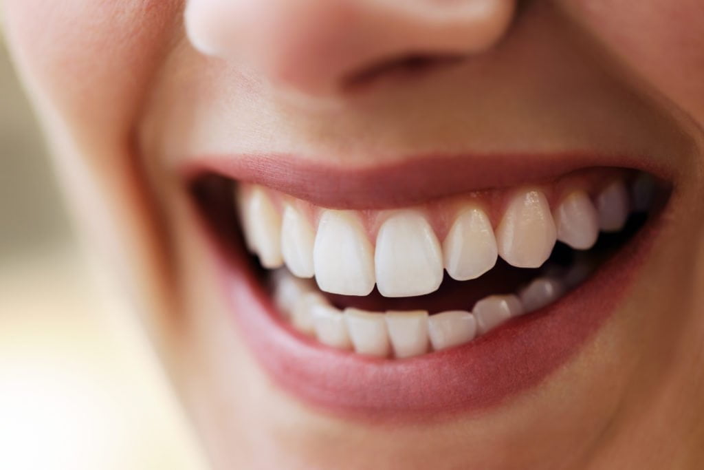smile makeover