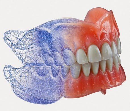 Advantages of Digital Dentures