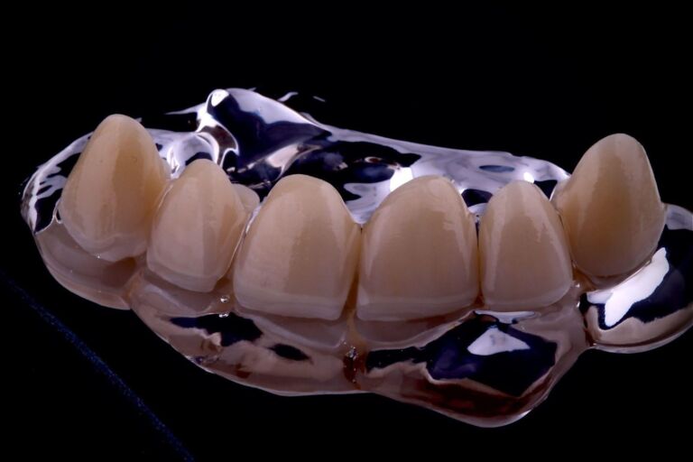 Dental Crowns