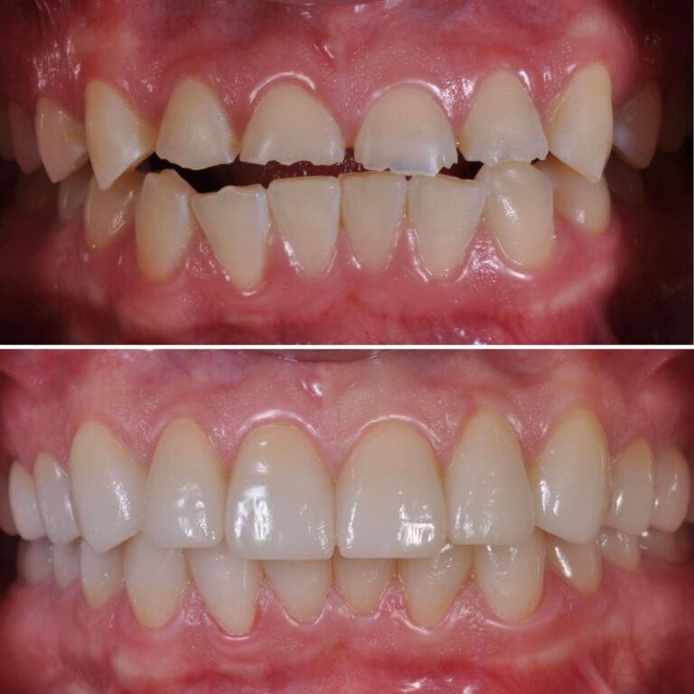 Dental Reconstruction