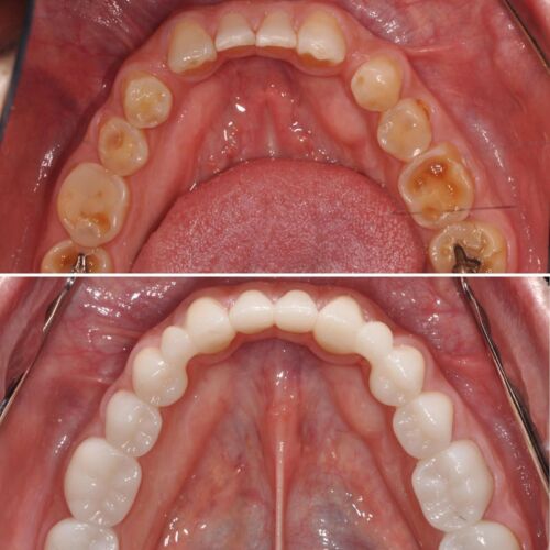 Dental Reconstruction before and after