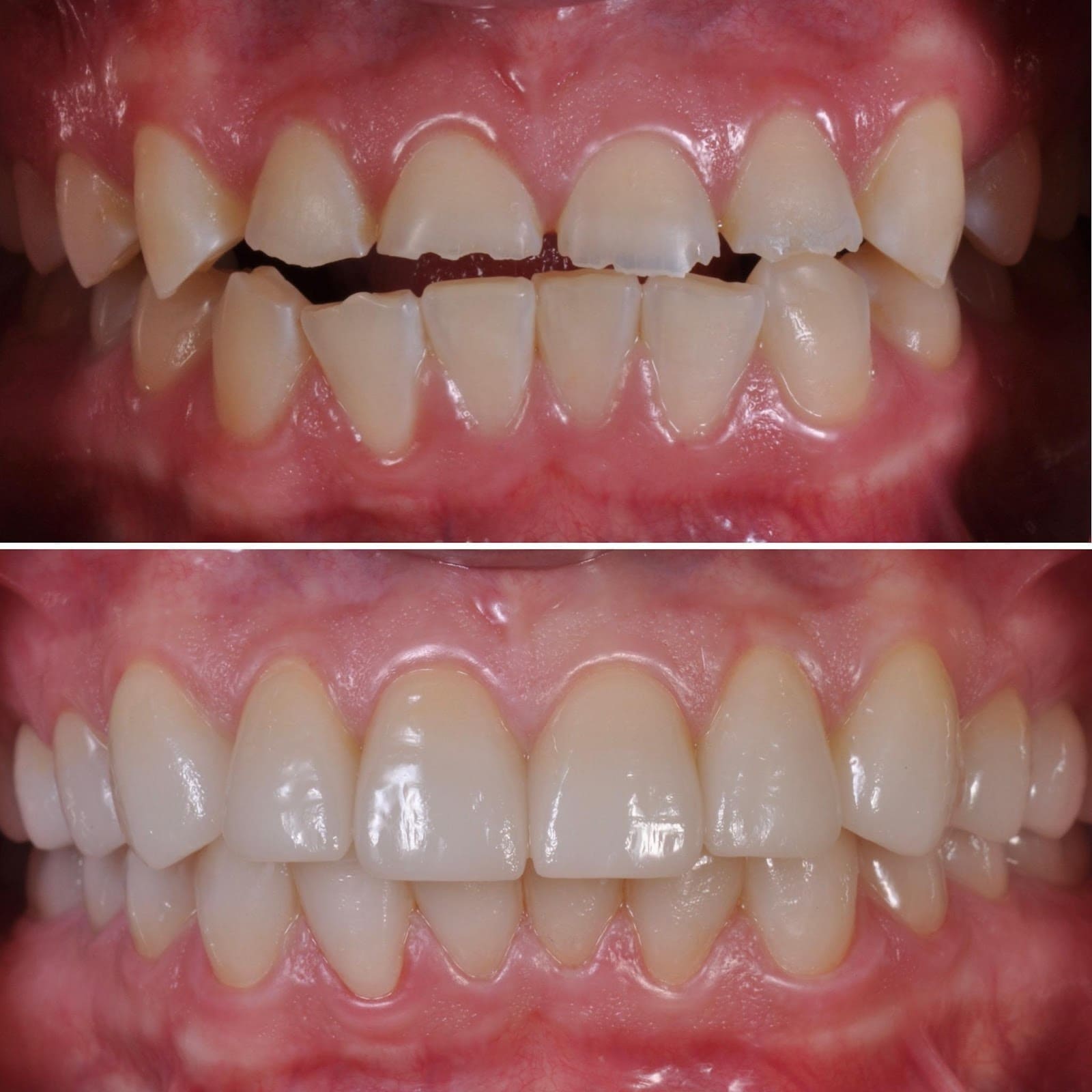 Dental Reconstruction Explained Transcend Dentistry