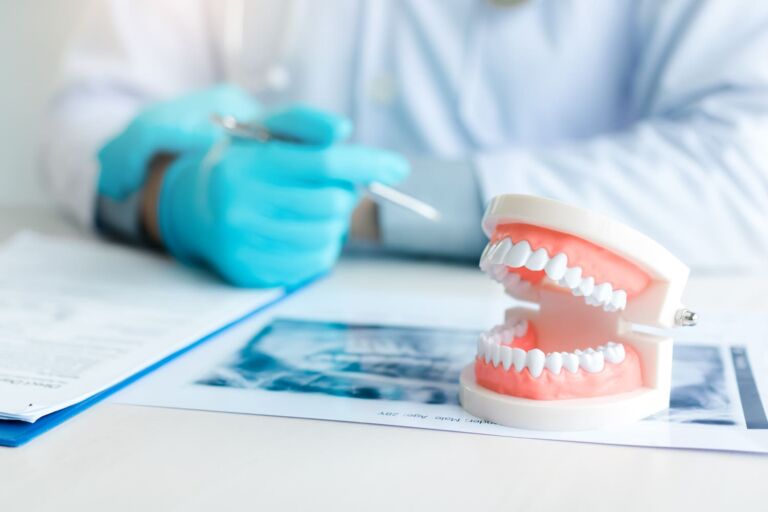 Dental Rehabilitation Dentures
