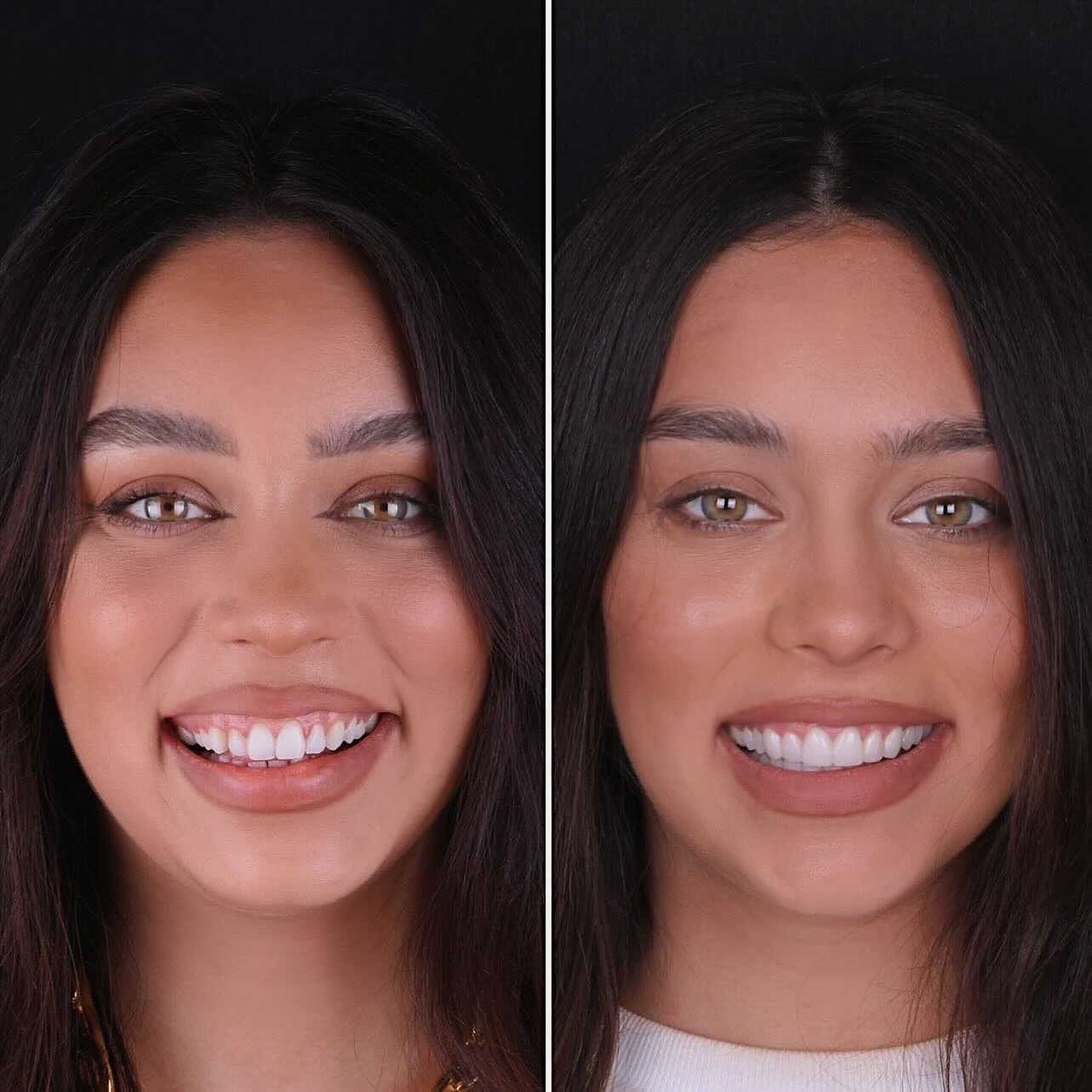 Janice B&A Final